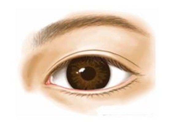 什么是双眼皮修复 什么情况下需要双眼皮修复